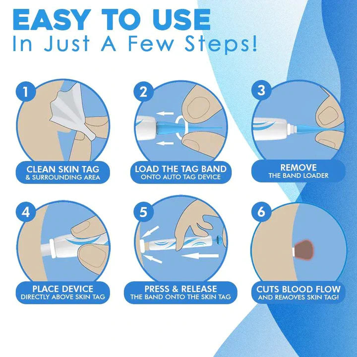 Elara | Schnell-Entfernungs-Kit Für Schnelle Und Schmerzfreie Hautpflege