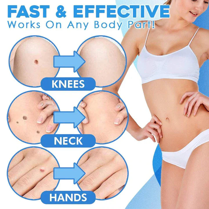 Elara | Schnell-Entfernungs-Kit Für Schnelle Und Schmerzfreie Hautpflege