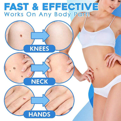 Elara | Schnell-Entfernungs-Kit Für Schnelle Und Schmerzfreie Hautpflege