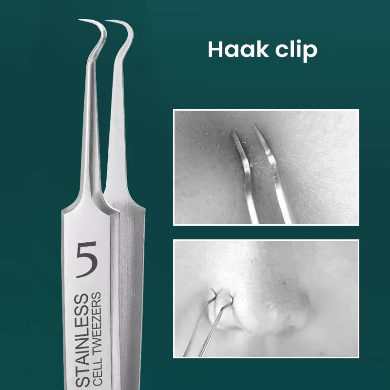 HautGreif™ Zielgerichtete Pickelentfernung